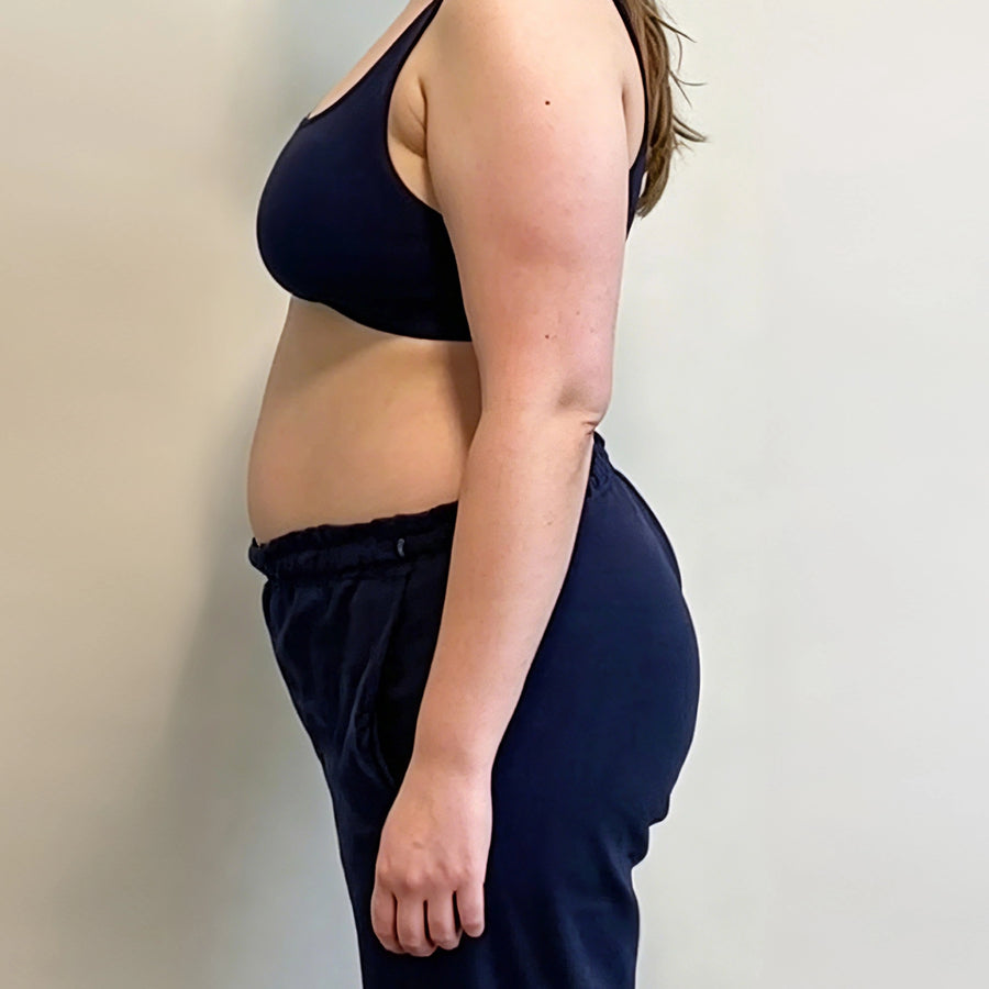 Side profile before 4 weeks of daily wellness routine